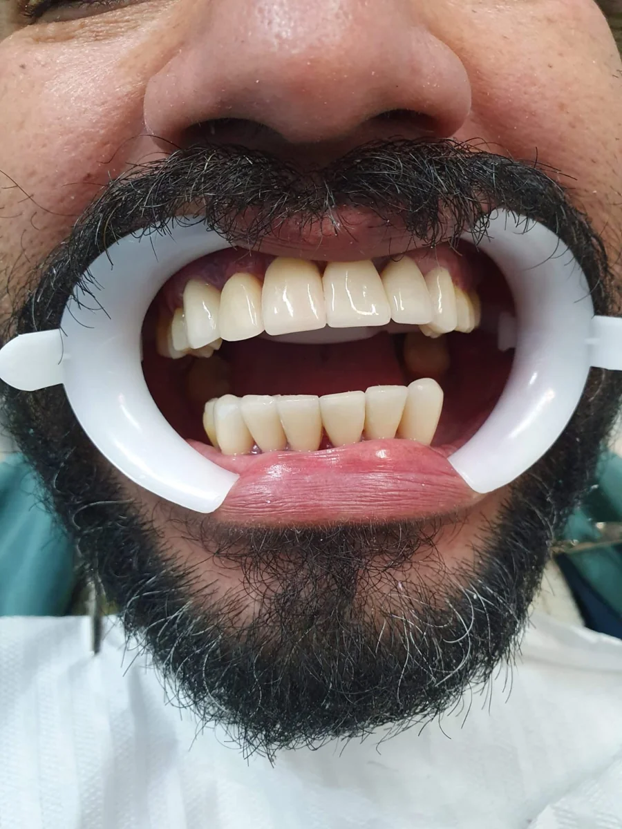 Resultado do tratamento
